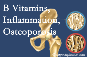 Murfreesboro chiropractic care of osteoporosis usually comes with nutritional tips like b vitamins for inflammation reduction and for prevention.