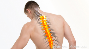 Murfreesboro thoracic spine pain image 