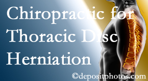 Most Chiropractic Clinic diagnoses and treats thoracic disc herniation pain and relieves its symptoms like unexplained abdominal pain or other gastrointestinal issues. 