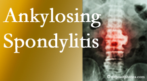 Ankylosing spondylitis is gently cared for by your Murfreesboro chiropractor.