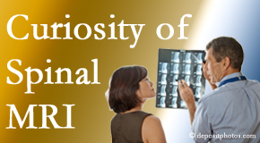 Murfreesboro MRIs for spinal stenosis may be revealing…or puzzling.