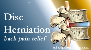 Most Chiropractic Clinic offers non-surgical treatment for relief of disc herniation related back pain. 