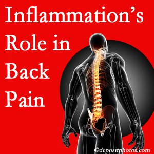 The role of inflammation in Murfreesboro back pain is real. Chiropractic care can manage it.