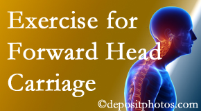 Murfreesboro chiropractic treatment of forward head carriage is two-fold: manipulation and exercise.