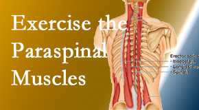 Most Chiropractic Clinic explains the importance of paraspinal muscles and their strength for Murfreesboro back pain relief.