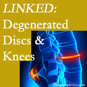 Degenerated discs and degenerated knees are not such unlikely companions. They are seen to be related. Murfreesboro patients with a loss of disc height due to disc degeneration often also have knee pain related to degeneration.  