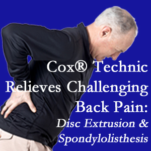 Murfreesboro chiropractic care with Cox Technic alleviates back pain due to a painful combination of a disc extrusion and a spondylolytic spondylolisthesis.