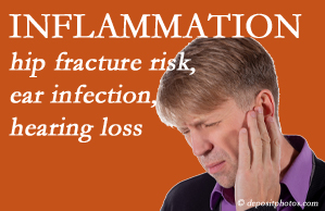 Most Chiropractic Clinic recognizes inflammation’s role in pain and presents how it may be a link between otitis media ear infection and increased hip fracture risk. Interesting research!