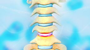 Murfreesboro disc degeneration health