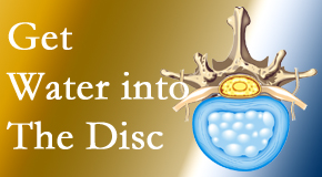 Most Chiropractic Clinic uses spinal manipulation and exercise to boost the diffusion of water into the disc which supports the health of the disc.