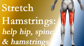 Most Chiropractic Clinic encourages back pain patients to stretch hamstrings for length, range of motion and flexibility to support the spine.