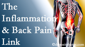 Most Chiropractic Clinic tackles the inflammatory process that accompanies back pain as well as the pain itself.