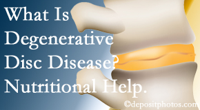Most Chiropractic Clinic treats degenerative disc disease with chiropractic treatment and nutritional interventions. 