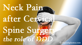 Most Chiropractic Clinic offers gentle care for neck pain after neck surgery.