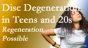 Most Chiropractic Clinic relieves back pain due to disc degeneration in younger people in their teens and 20s. 