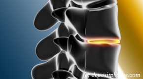 Murfreesboro degenerative spinal changes 