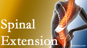 Most Chiropractic Clinic knows the role of extension in spinal motion, its necessity, its benefits and potential harmful effects. 