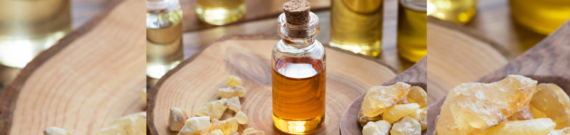 Murfreesboro anti-inflammatory frankincense