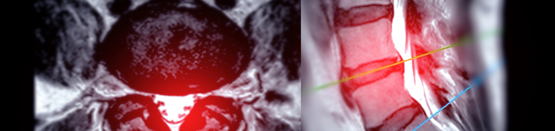 Murfreesboro back pain imaging and exercise