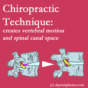 image of a Murfreesboro spinal stenotic canal