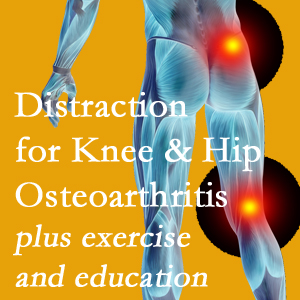 A chiropractic treatment plan for Murfreesboro knee pain and hip pain caused by osteoarthritis: education, exercise, distraction.