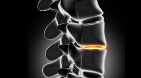 Murfreesboro chiropractic nutrition with vitamin D and quercitrin