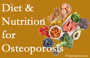 Murfreesboro osteoporosis prevention tips from your chiropractor include improved diet and nutrition and decreased sodium, bad fats, and sugar intake. 