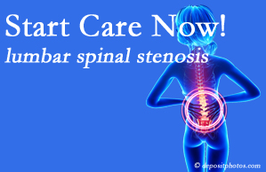 Most Chiropractic Clinic presents research that emphasizes that non-operative treatment for spinal stenosis within a month of diagnosis is beneficial. 