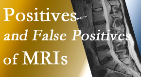 Most Chiropractic Clinic carefully decides when and if MRI images are needed to guide the Murfreesboro chiropractic treatment plan. 